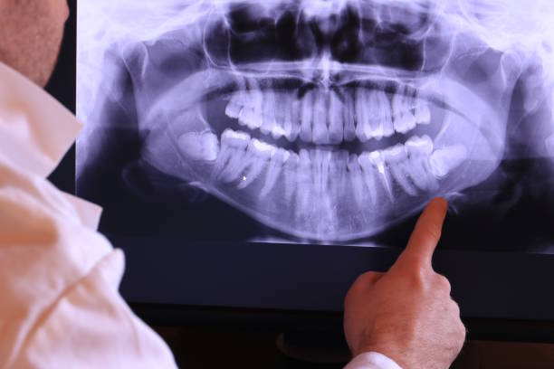 Best Knocked-Out Tooth Emergency  in Ogdensburg, NY